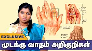 முடக்கு வாதம் அறிகுறிகள் தீர்வு என்ன  arthritis Siddha Treatment  Tamil health tips [upl. by Naryk]