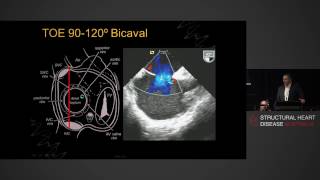 Anatomy of the small intestine  dissection [upl. by Eevets175]