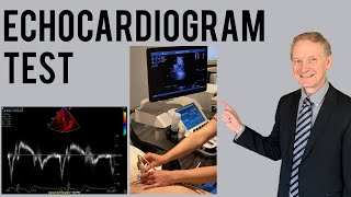 Echocardiogram Procedure  Heart Ultrasound  Everything you need to know [upl. by Galanti]