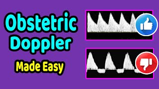 Obstetric Doppler Made Easy [upl. by Hirst774]