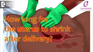 How can I make my uterus healthyWays to care of your uterusDrMeghana D Sarvaiya of C9 Hospitals [upl. by Packton]