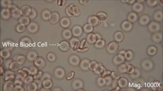 Red blood cells under the microscope hypo and hypertonic solutions [upl. by Oznola]