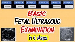 Basic Fetal Ultrasound Examination [upl. by Fawna227]