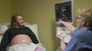 Ultrasounds during pregnancy [upl. by Hanson]