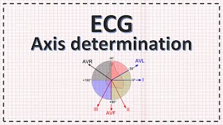 Cardiac Axis Determination  ECG Axis  Simplified [upl. by Kallista656]