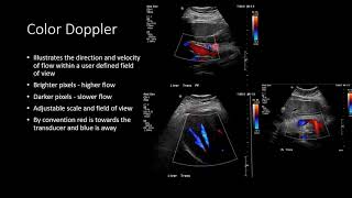 Ultrasound Physics  Types of Doppler Ultrasound [upl. by Eserehs659]