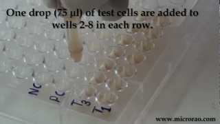 Treponema Pallidum Hemagglutination TPHA test for syphilis [upl. by Nottarts]