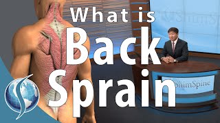 What is a Back Sprain [upl. by Darell]