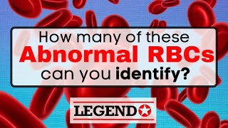 How many abnormal RBC forms can you identify  Legend Review Center [upl. by Adyl431]