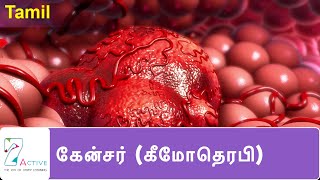 புற்றுநோய்  கீமோதெரபி   Cancer Chemotherapy  Tamil [upl. by Emmye]