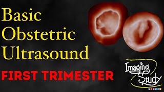 Basic Obstetric Ultrasound First Trimester Pregnancy [upl. by Ahsilif]