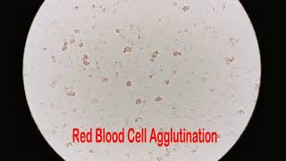 Red Blood Cell Under the Microscope 400X and 1000X  Part 3 RBC Agglutination [upl. by Valerio]