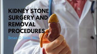 Kidney Stone Surgery amp Removal Procedures  Dr Brian D Hale [upl. by Steven]