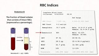 How to Interpret RBC Indices eg hemoglobin vs hematocrit MCV RDW [upl. by Javed]