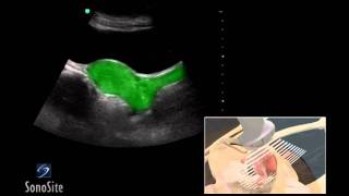 How To Female Pelvis Ultrasound Exam 3D Video [upl. by Tillford]