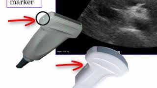 Introduction to Radiology Ultrasound [upl. by Vacla48]