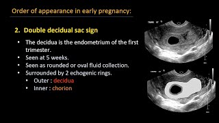 Ultrasound of normal early pregnancy [upl. by Lore280]