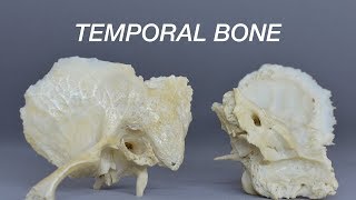 TEMPORAL BONE [upl. by Lowe168]