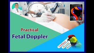 Practical Obstetric Doppler  Uterine Artery Doppler [upl. by Arema]