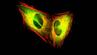 Actin and tubulin during mitosis [upl. by Akemehc746]