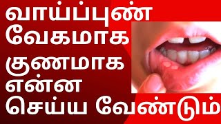 வாய் புண் வேகமாக குணமாக  vaai pun treatment in tamil  Mouth Ulcer Treatment [upl. by Weismann]