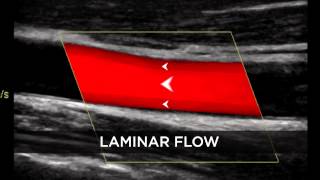 Introduction to Doppler Ultrasound [upl. by Charla523]