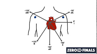 Understanding ECG Axis and Axis Deviation [upl. by Niawd329]