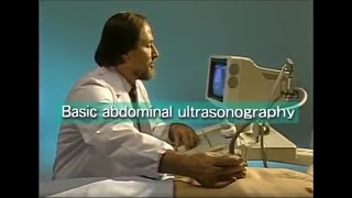 How to do abdominal ultrasound examination [upl. by Parrott]