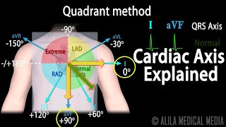 Cardiac Axis Interpretation Animation [upl. by Atlee]